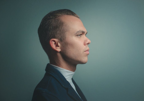 5 feiten over haartransplantaties die je waarschijnlijk nog niet wist